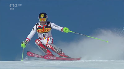 6093cf4cc0401_hir3_flexion1_small.jpg