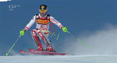 6093cfa35ce64_hir3_flexion5_small.jpg
