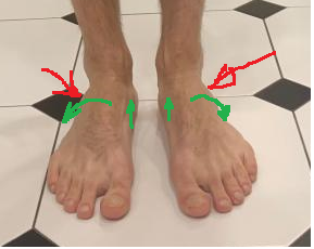 5ec426d3d1c79_troubled_feet.png