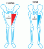 patellofemoral-pain-syndrome-8.gif
