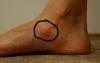 foot1.jpg