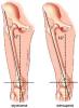 knee_man_woman.jpg